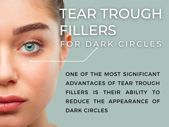 Tear Trough Filler in Roydon