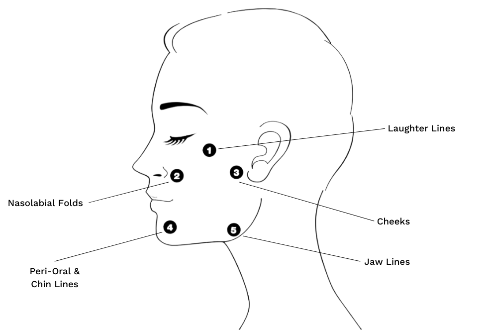Profhilo treatment in Roydon